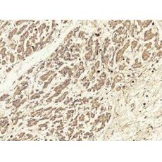 兔抗PRKCABDEGHQZ多克隆抗體