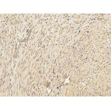 兔抗PRKCABDEGHQZ多克隆抗體