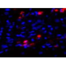 兔抗PRKCABDEGHQZ多克隆抗體