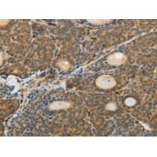 兔抗MSN多克隆抗體