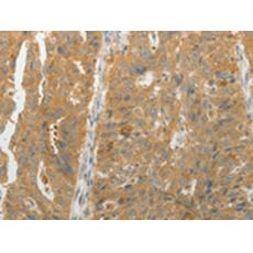 兔抗MAP4K5多克隆抗體