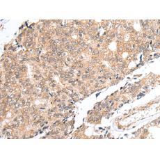 兔抗PRELID1多克隆抗體