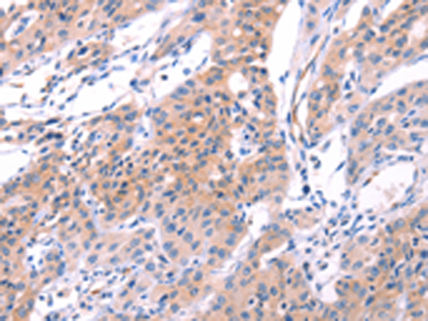 兔抗VWF多克隆抗體 