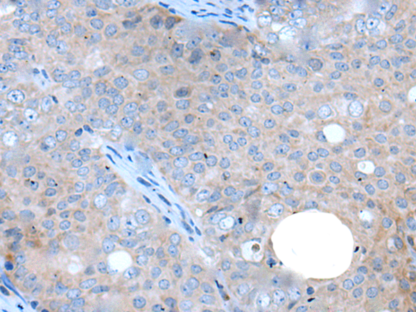 兔抗WAPL多克隆抗體  