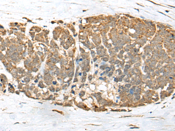  兔抗WARS2多克隆抗體 