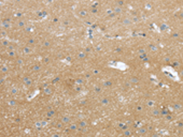 兔抗WASF2多克隆抗體 