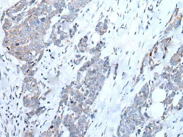 兔抗WASF3多克隆抗體   