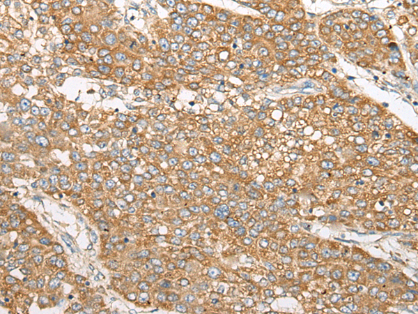  兔抗WBP1多克隆抗體