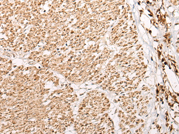 兔抗WDFY3多克隆抗體 