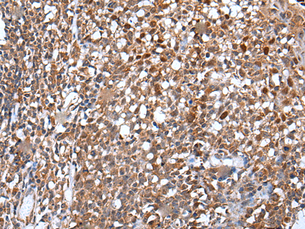  兔抗WDHD1多克隆抗體 