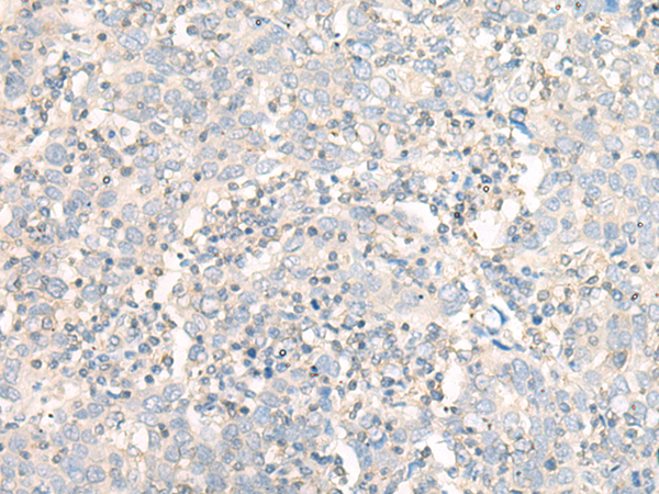 兔抗WDR1多克隆抗體    