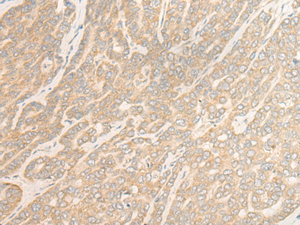  兔抗WDR6多克隆抗體 