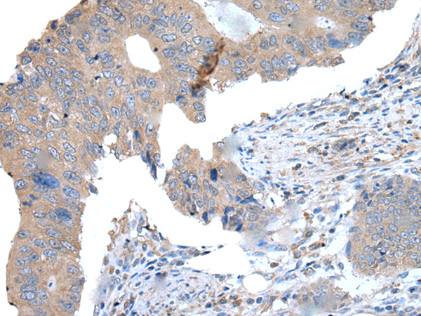 兔抗WDR11多克隆抗體  