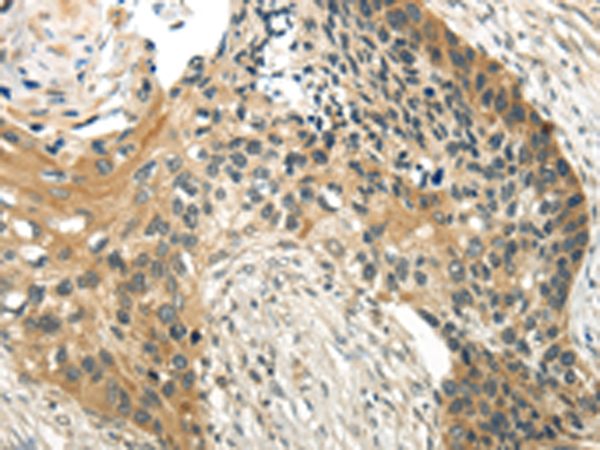 兔抗WDR36多克隆抗體 