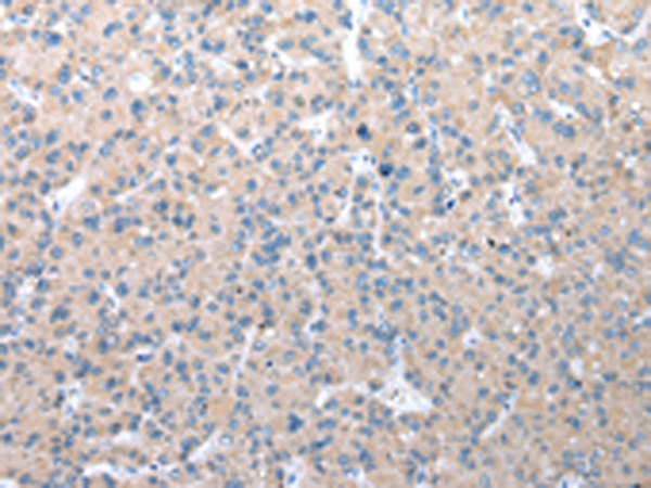 兔抗WDR41多克隆抗體 