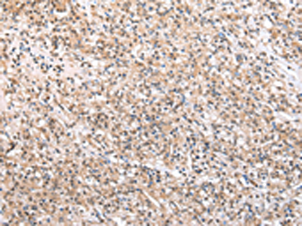 兔抗WDR45多克隆抗體 