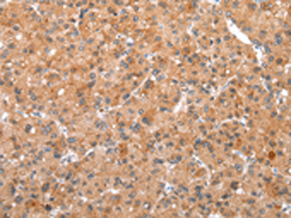 兔抗WDR61多克隆抗體 