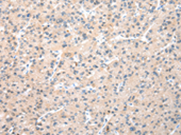 兔抗WDR77多克隆抗體   