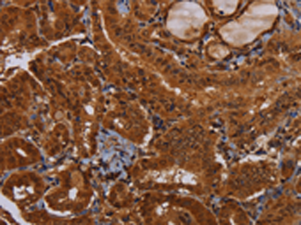 兔抗WDR83多克隆抗體