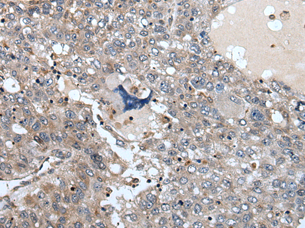 兔抗WDSUB1多克隆抗體 