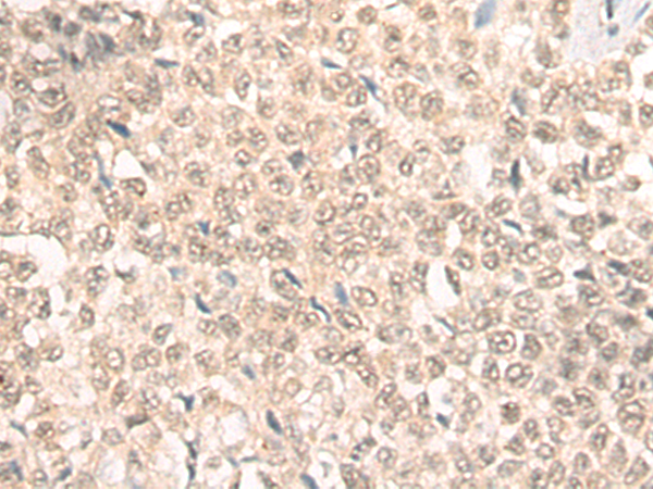 兔抗WEE1多克隆抗體