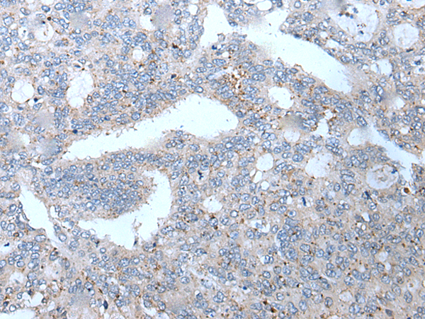  兔抗WFDC12多克隆抗體  