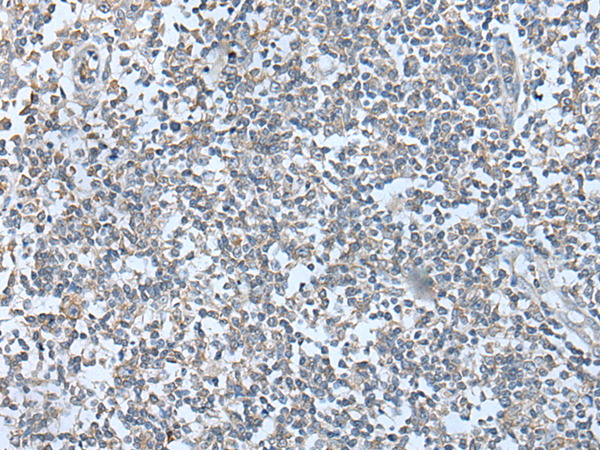 兔抗WFS1多克隆抗體  