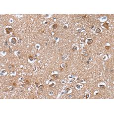 兔抗WAPL多克隆抗體  