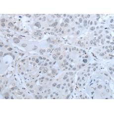 兔抗WASF3多克隆抗體   