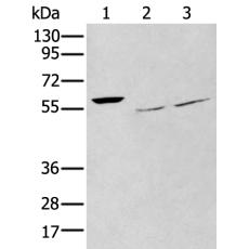 兔抗WASF3多克隆抗體   