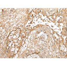  兔抗WBP1多克隆抗體