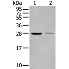  兔抗WBP1多克隆抗體