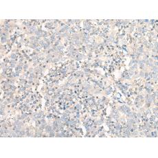 兔抗WDR1多克隆抗體    