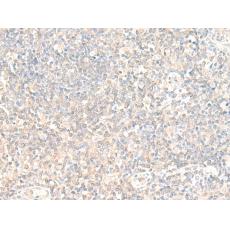 兔抗WDR1多克隆抗體    