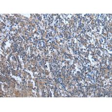 兔抗WDR11多克隆抗體  