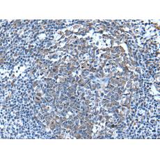  兔抗WFDC12多克隆抗體  