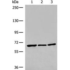 兔抗WHRN多克隆抗體  