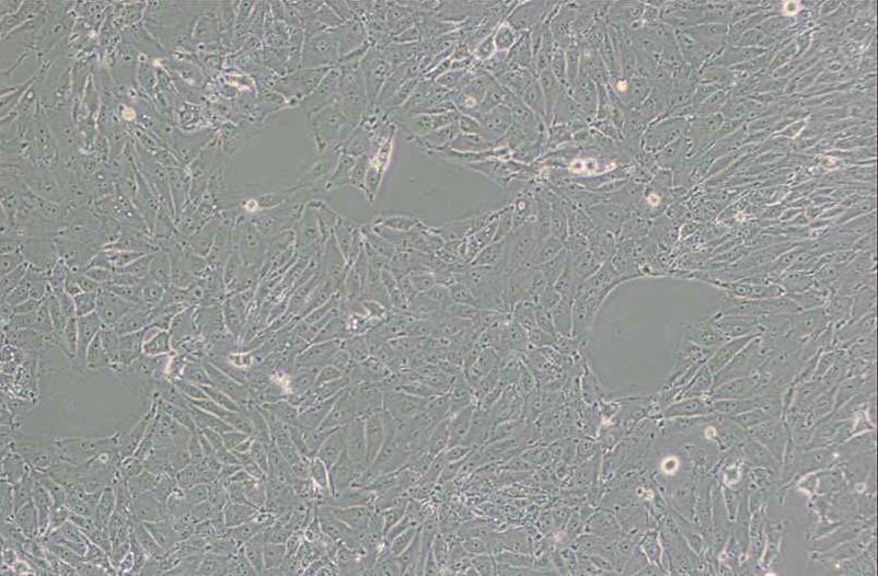 PED豬內(nèi)皮細胞