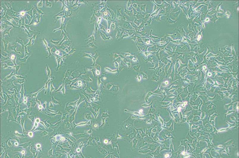 KYSE-410人食管鱗癌細(xì)胞